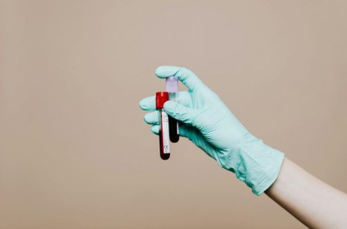 analisi-laboratorio-prevenzione-test